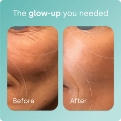 Biosil Collagen Booster label details highlight the patented ch-OSA activator