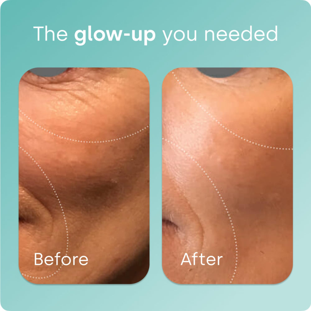 Biosil Collagen Booster skin glow image suggests improved radiance and elasticity