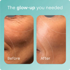 Biosil Collagen Booster skin glow image suggests improved radiance and elasticity