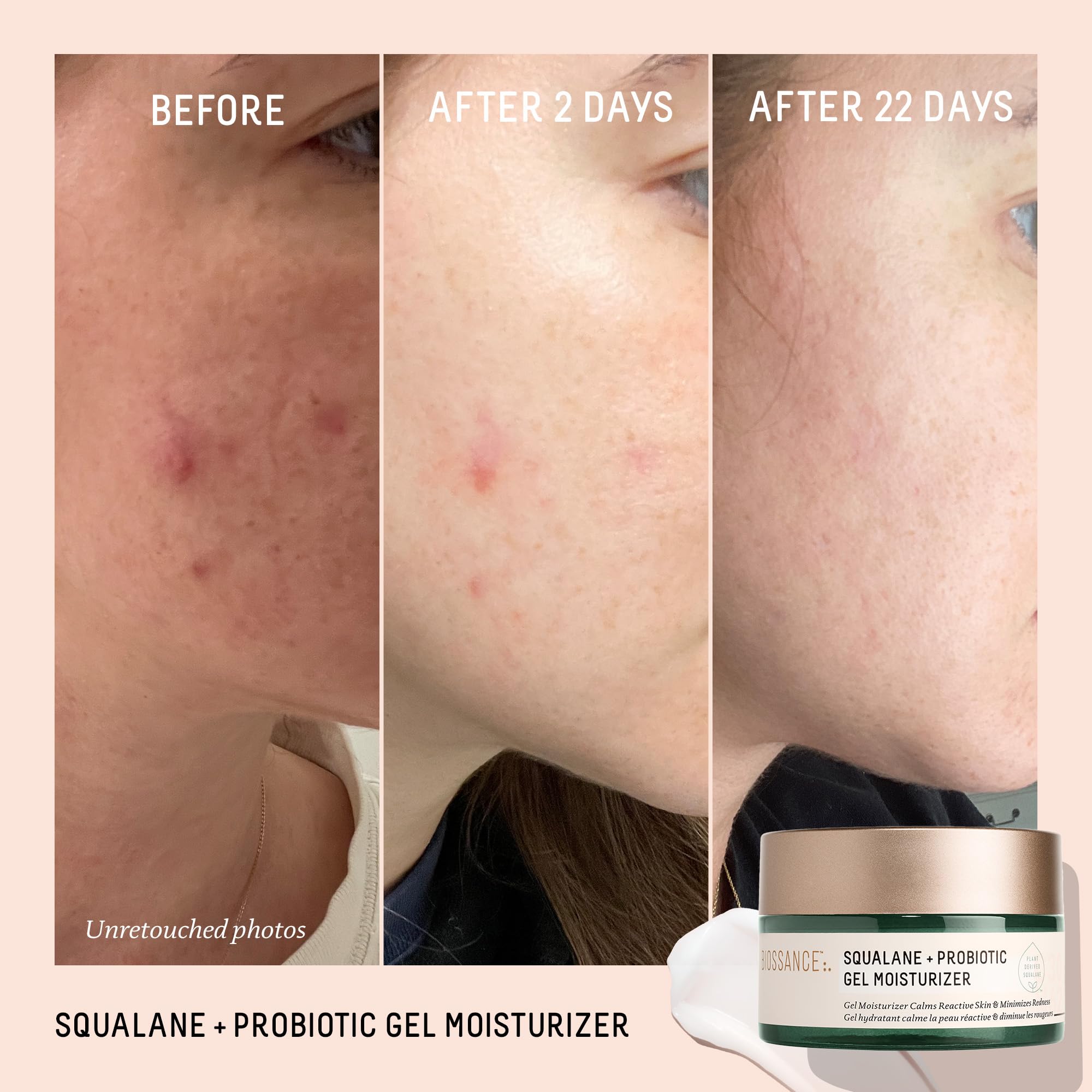 BIOSSANCE probiotic gel on skin demonstrating calming effect for sensitive skin.