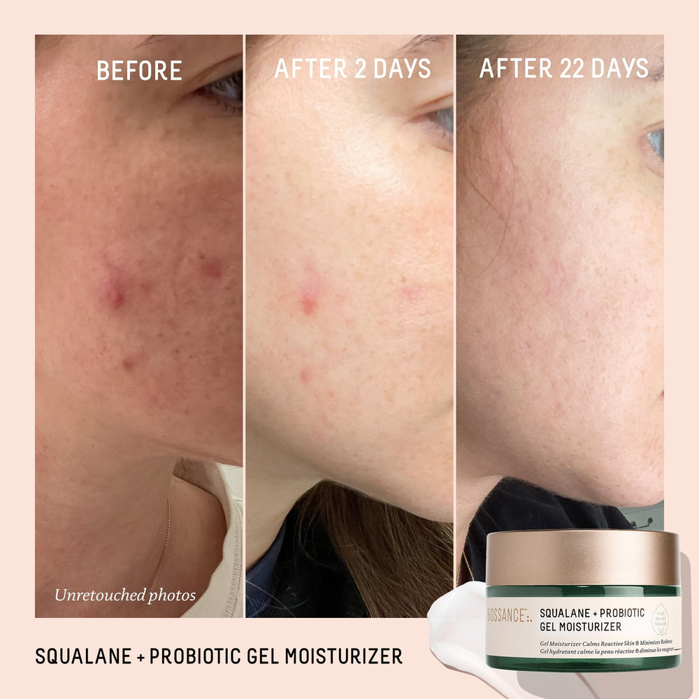 BIOSSANCE probiotic gel on skin demonstrating calming effect for sensitive skin.