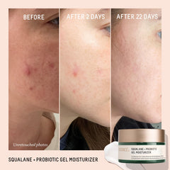 BIOSSANCE probiotic gel on skin demonstrating calming effect for sensitive skin.