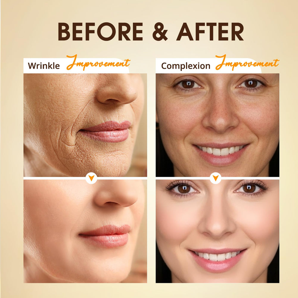 BIYSBER serum pump enables precise, quick application