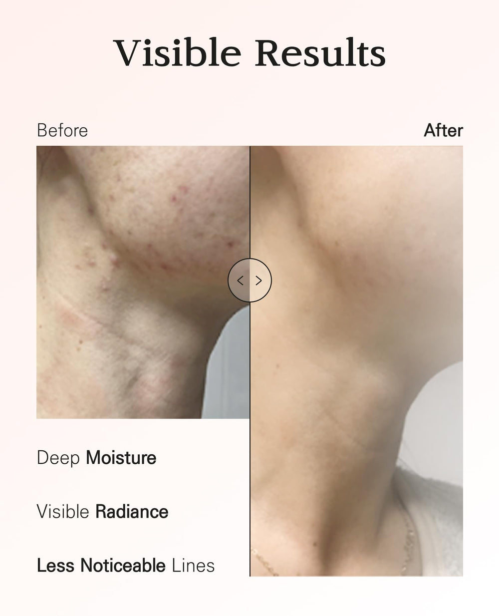 BLANC DUBU Nuborn Cell Hydrogel Neck Mask hyaluronic acid delivers deep hydration