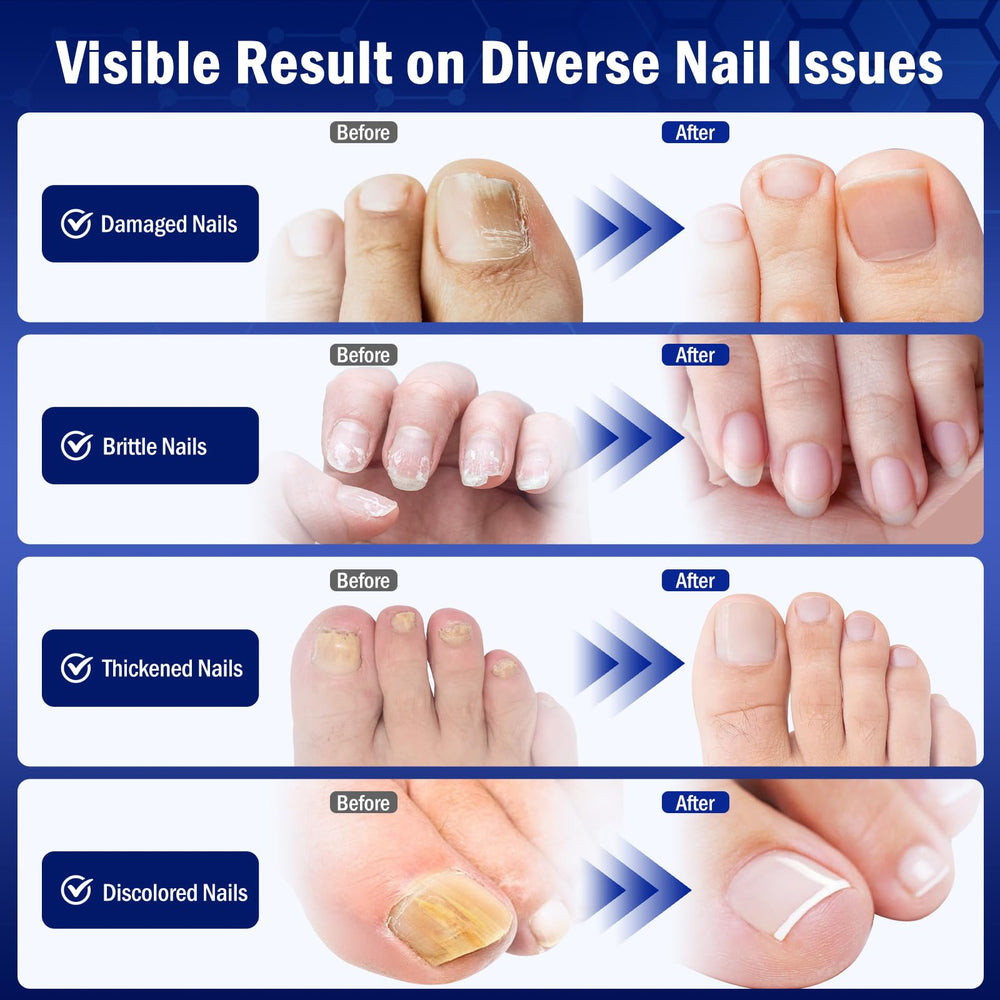 Bldaxn Toe Nail Fungus Renewal natural ingredients display with tea tree lavender and peppermint.