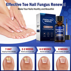 Bldaxn Toe Nail Fungus Renewal overnight use demonstration with patches securing solution.