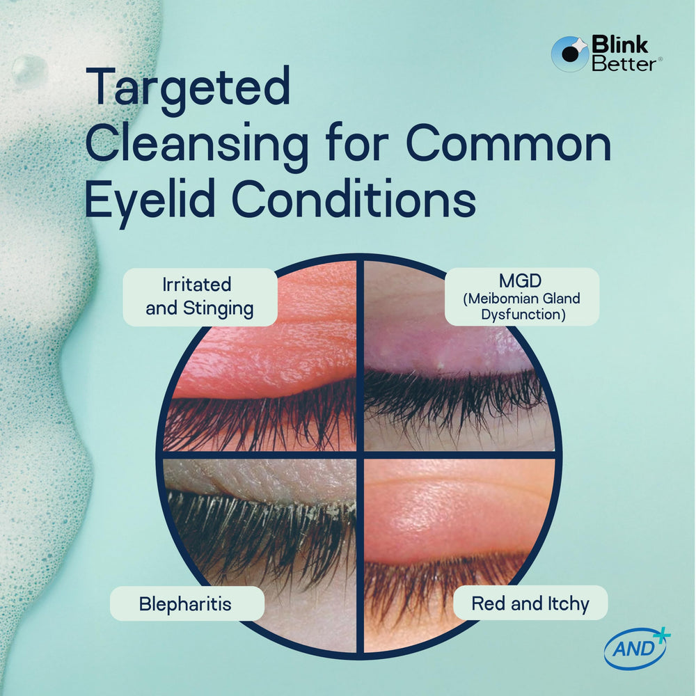 BlinkBetter BetterLids shown as lash extensions-friendly cleansing option.