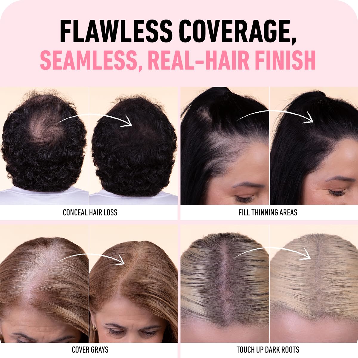 Boldify formula is lightweight and scalp-friendly with Squalene.