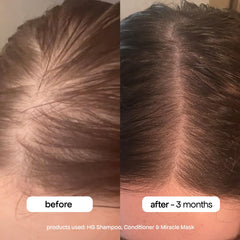 BondiBoost HG conditioner bottle close-up supports thicker-looking strands