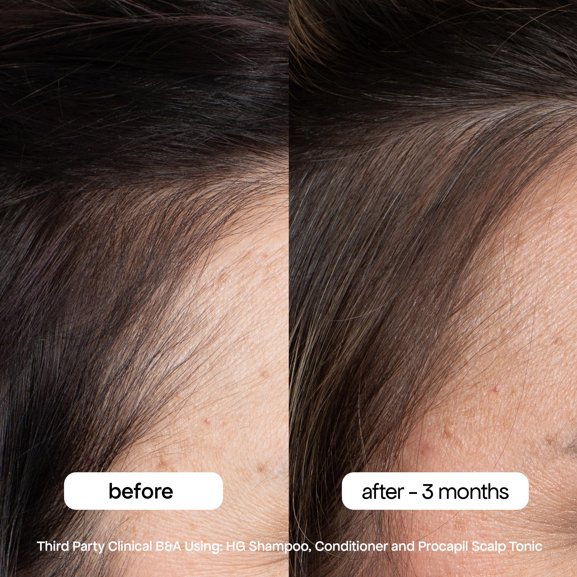 BondiBoost HG mint scent close-up evokes refreshing scalp feel