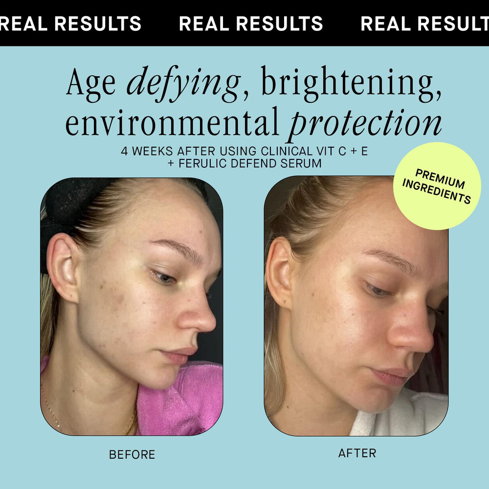 Brandefy Vitamin C Serum in morning routine scene for radiant skin.