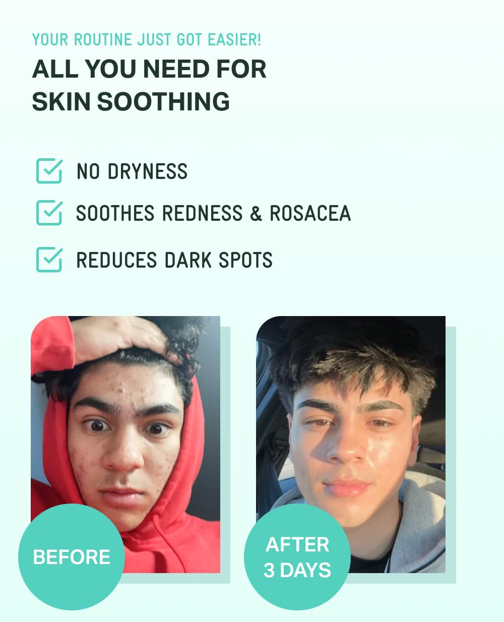 BRING GREEN Zinc TECA Serum drops on hand ready for application