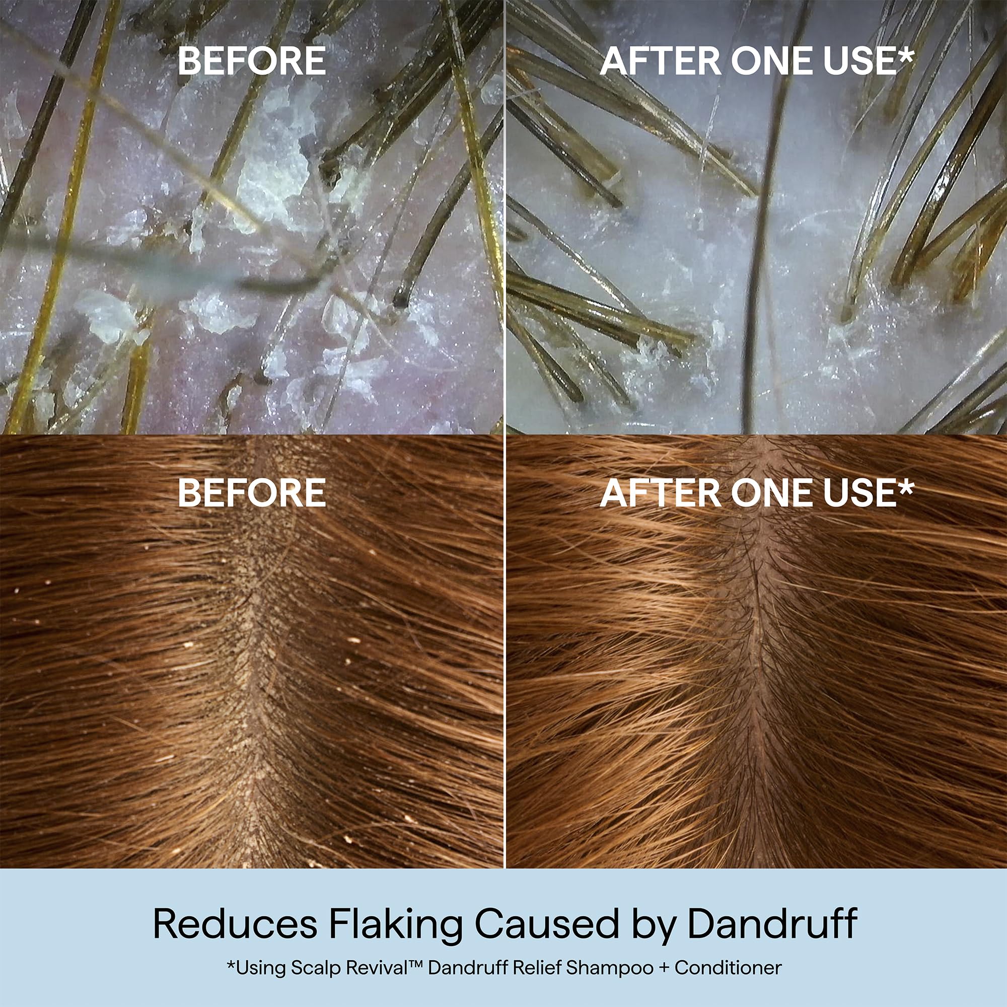 Briogeo Scalp Revival closeup with charcoal for purification