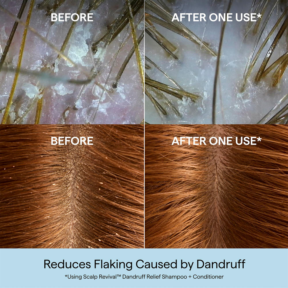 Briogeo Scalp Revival closeup with charcoal for purification