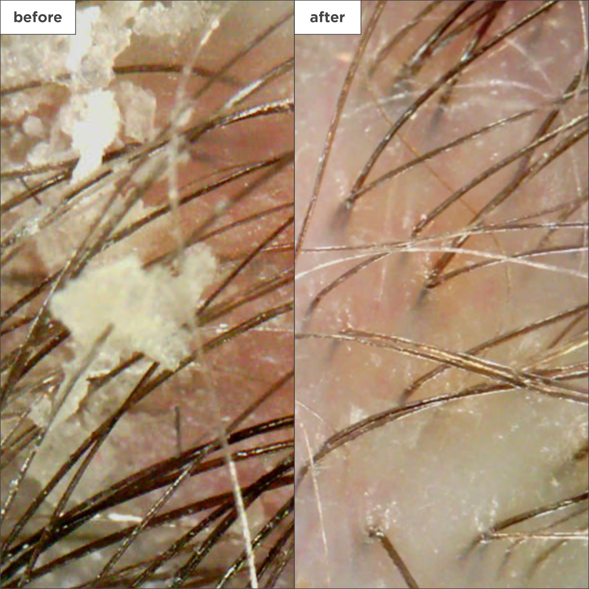 Briogeo Scalp Revival exfoliating particles visible for deep yet gentle cleansing