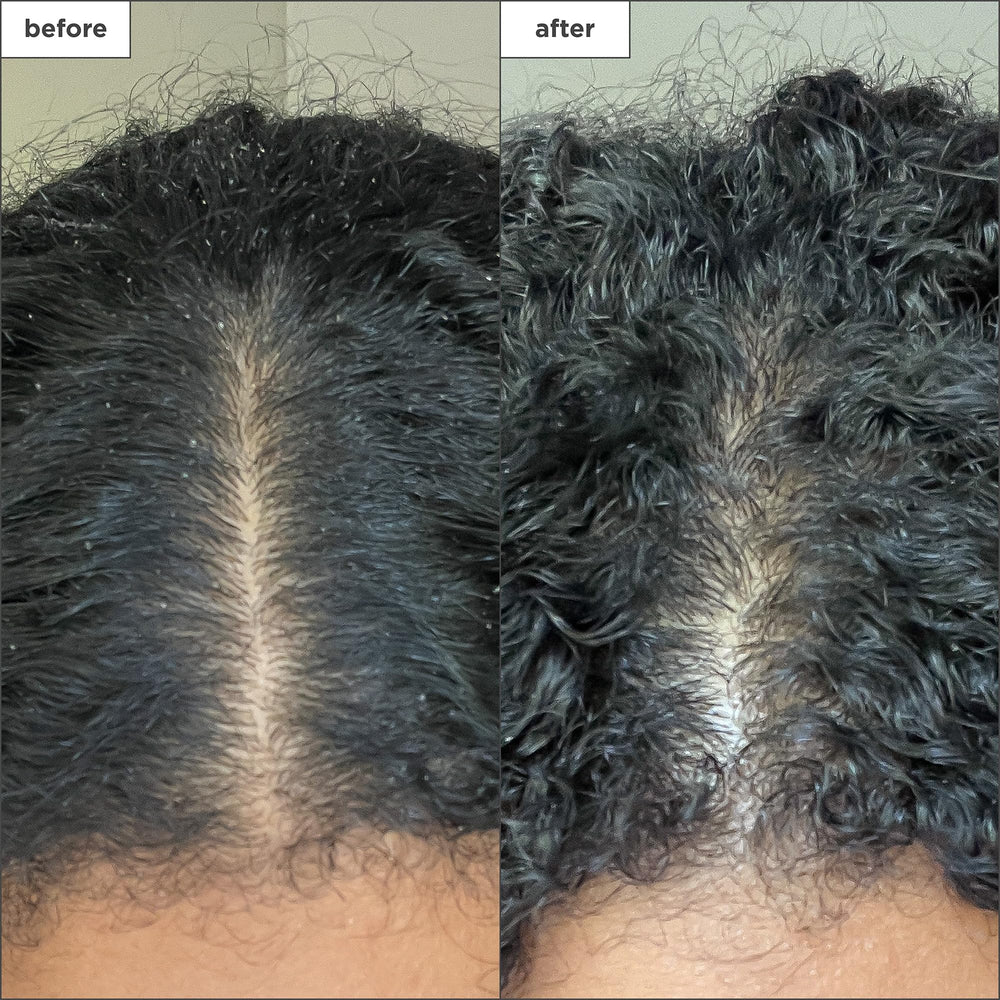 Briogeo Scalp Revival mint swirl indicating cooling, refreshing scalp sensation