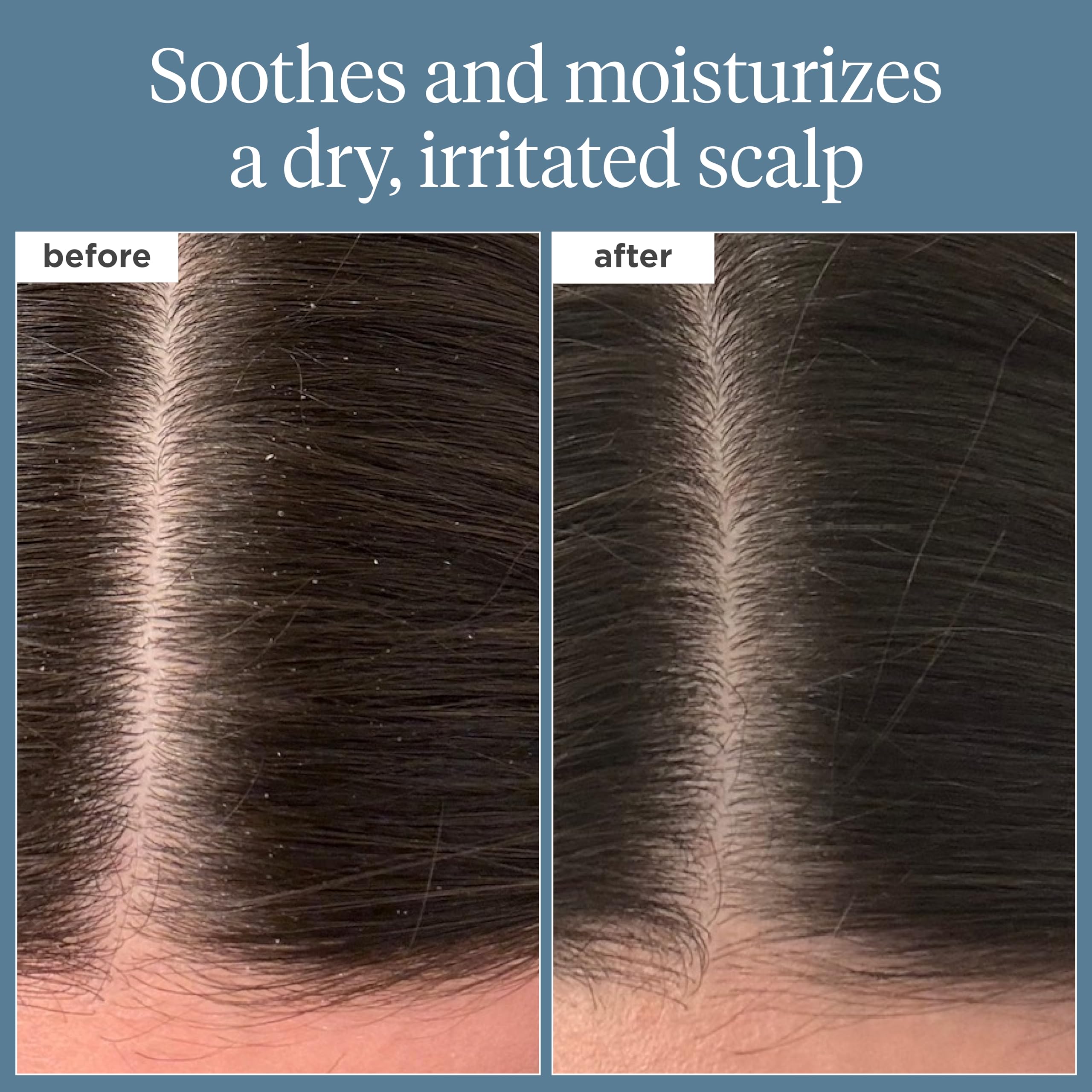 Briogeo Scalp Revival oil ingredients label highlighting rosemary and castor oil for hydration.