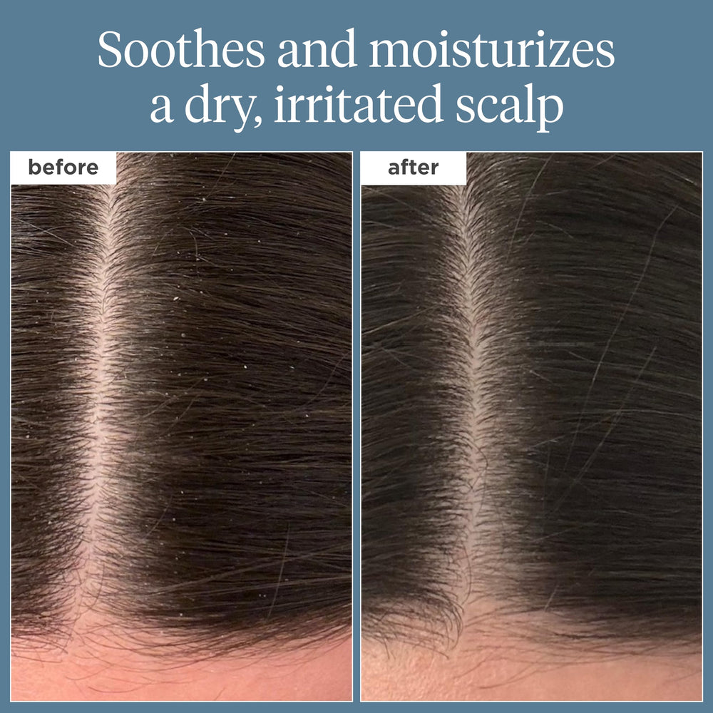 Briogeo Scalp Revival oil ingredients label highlighting rosemary and castor oil for hydration.