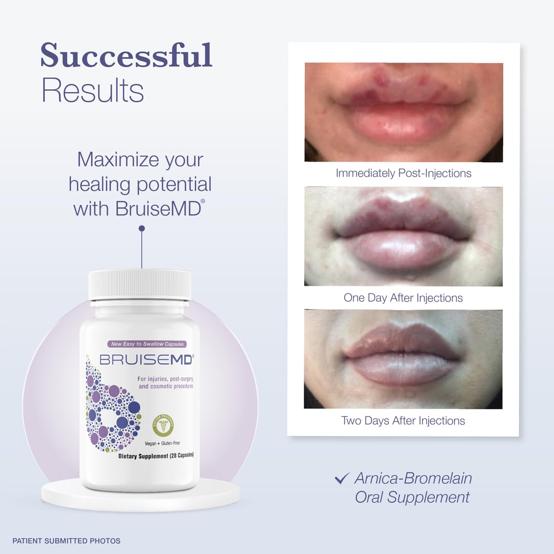BruiseMD easy-to-swallow capsules for daily swelling support