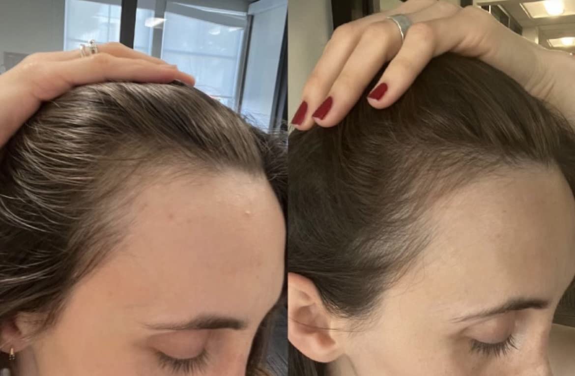 Pre-wash use scene with Bur Bur Growing Season oil for scalp preparation