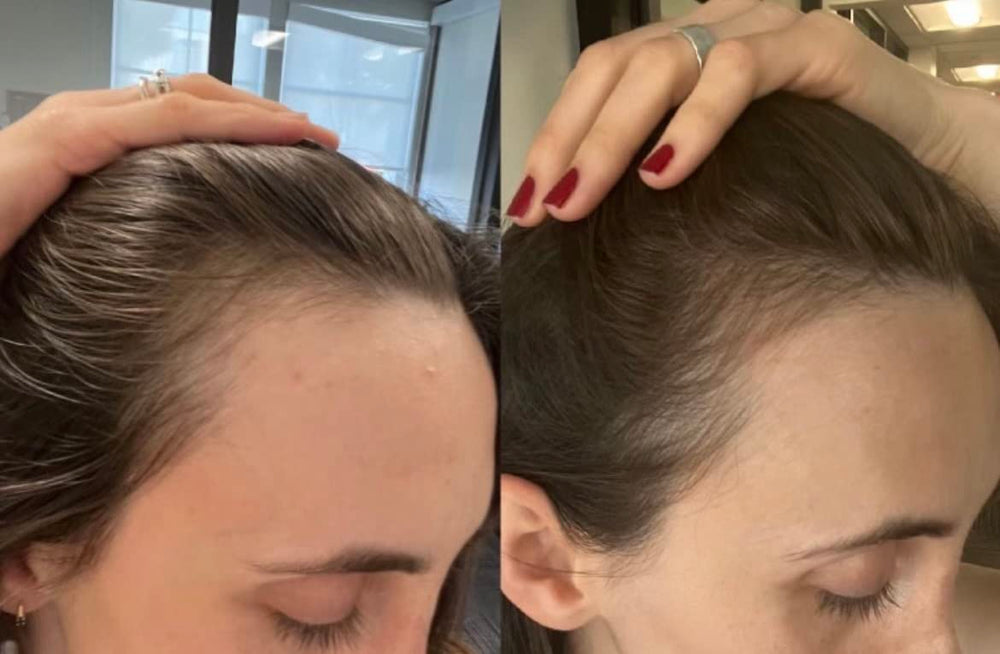 Pre-wash use scene with Bur Bur Growing Season oil for scalp preparation