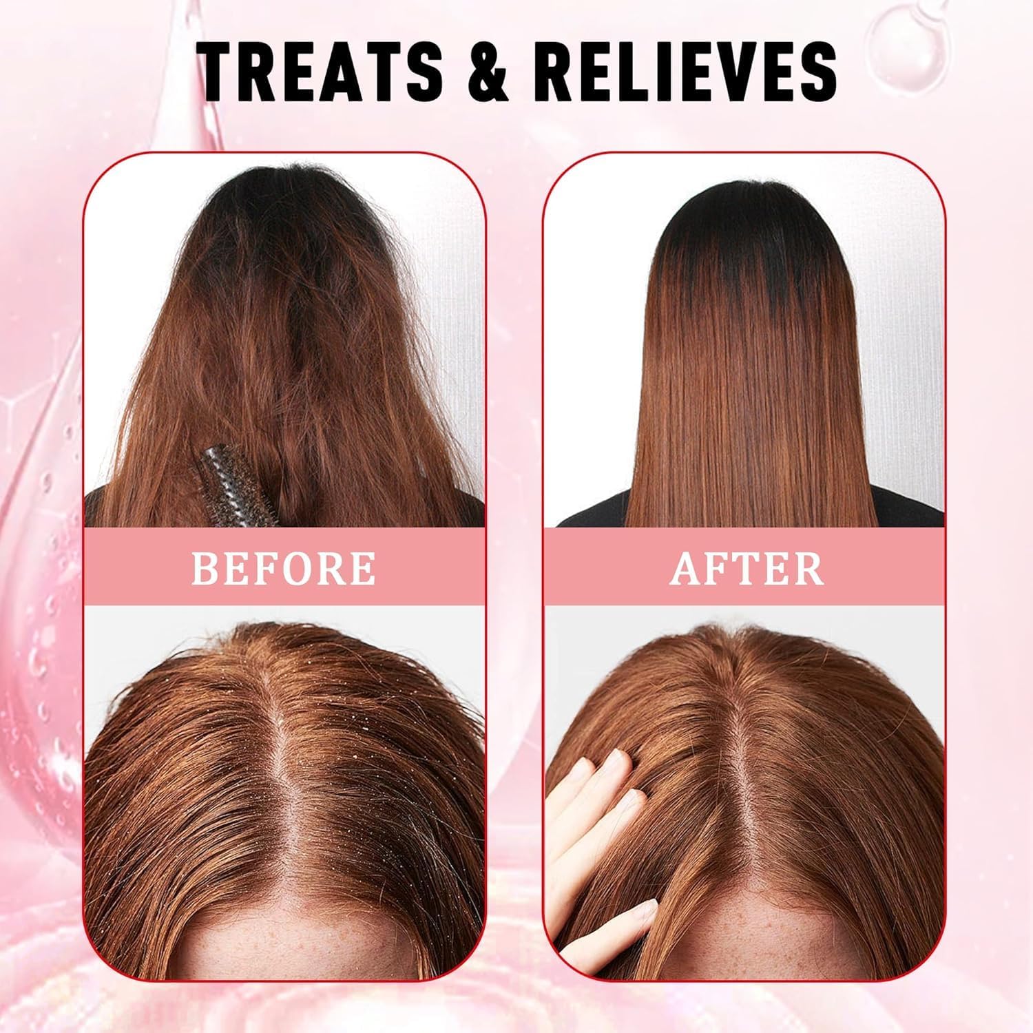 Color treated safe BYKYND LABS Avocado Oil Scalp Scrub