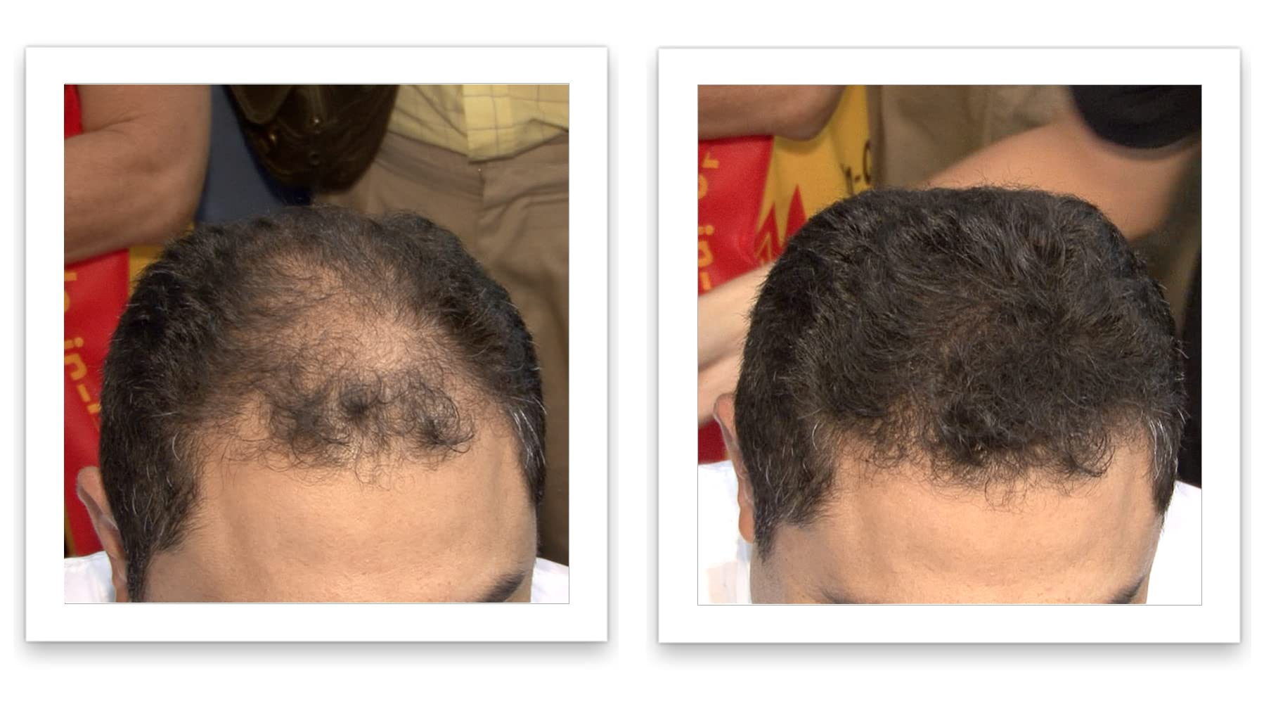 Caboki fibers blending with existing hair for a natural look