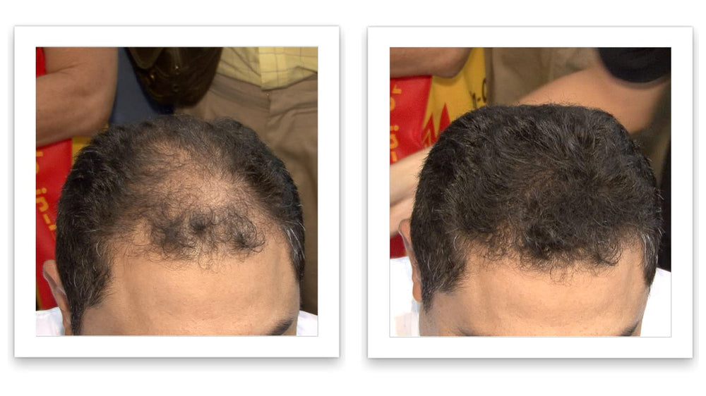 Caboki fibers blending with existing hair for a natural look