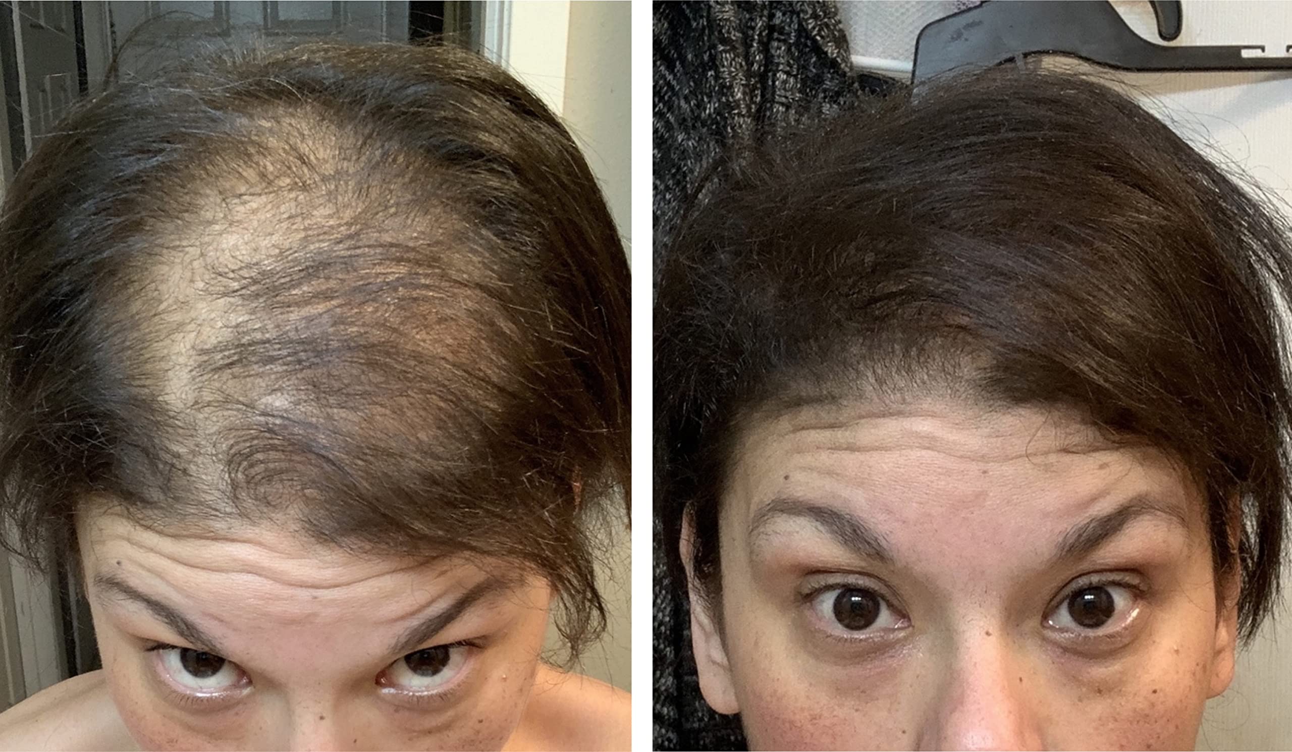 Caboki fibers wash out easily with shampoo