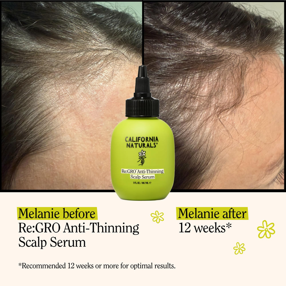 California Naturals Re:GRO serum dropper dispensing onto the scalp for targeted nourishment.