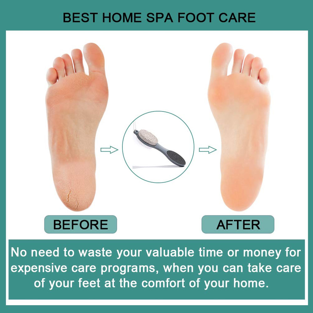 CAREHOOD Cleaning Brush detail for cleaning dead skin and debris