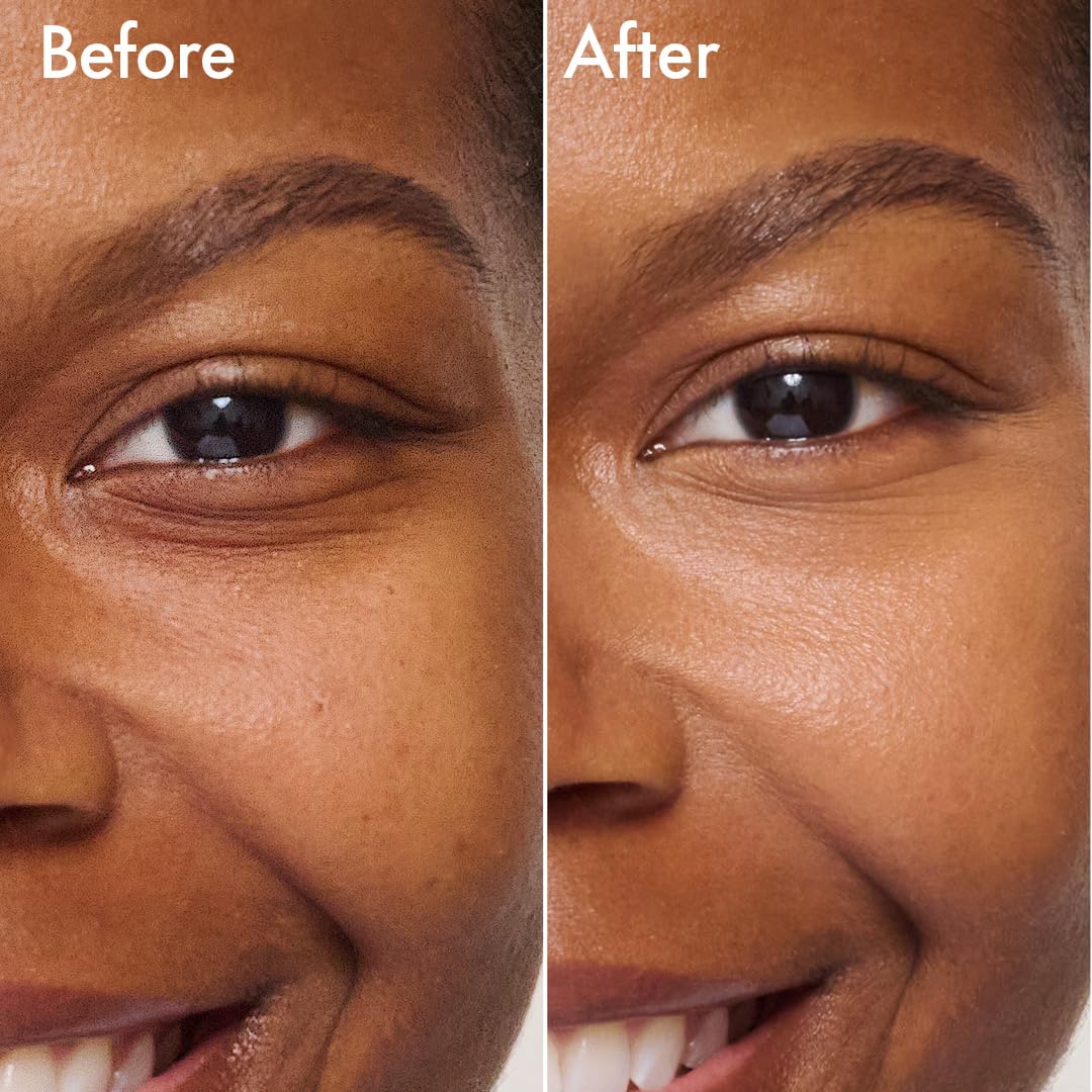 Catrice Under Eye Brightener hyaluronic acid detail emphasizes hydration and fullness.