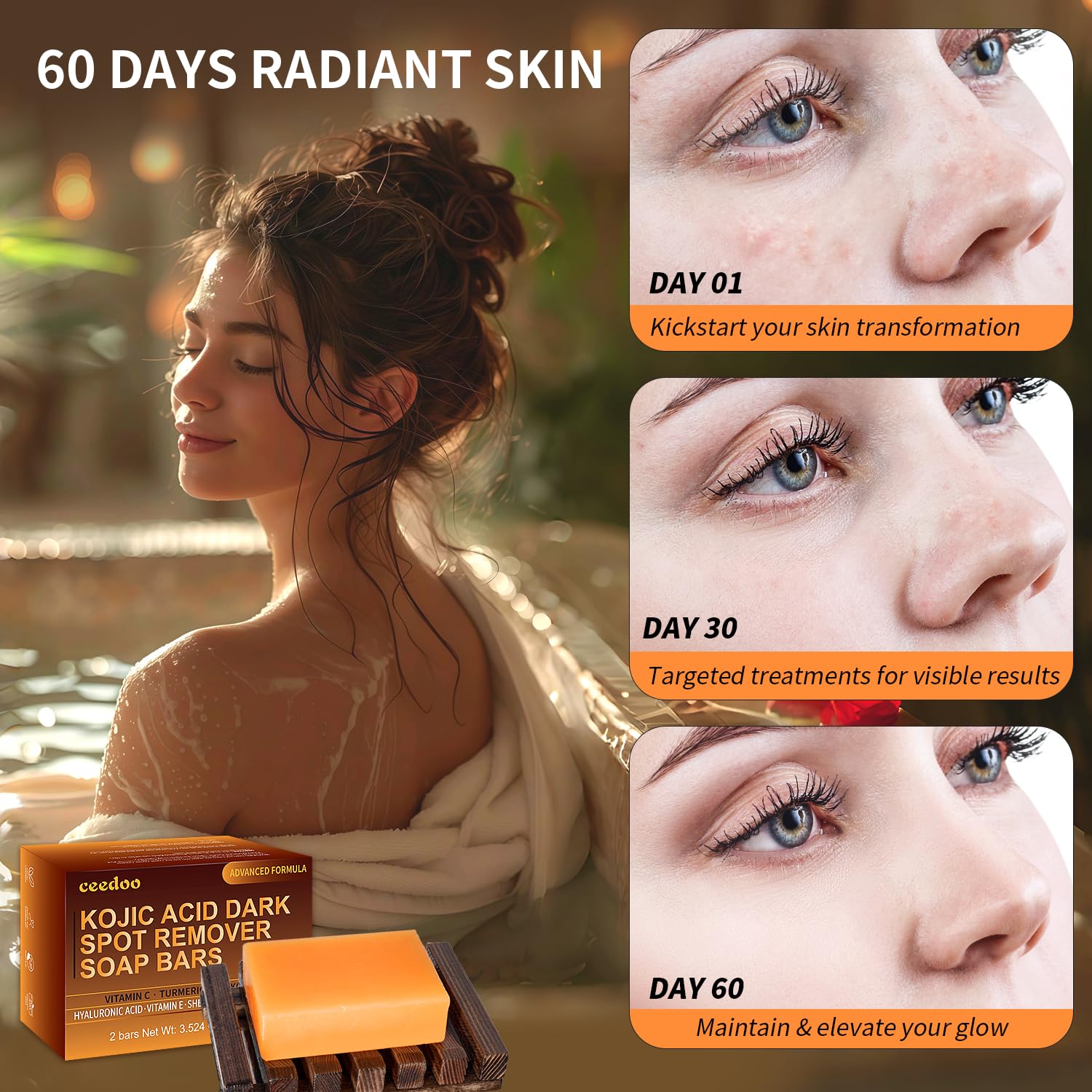 Ceedoo Kojic Acid Soap retinol-boost for renewal