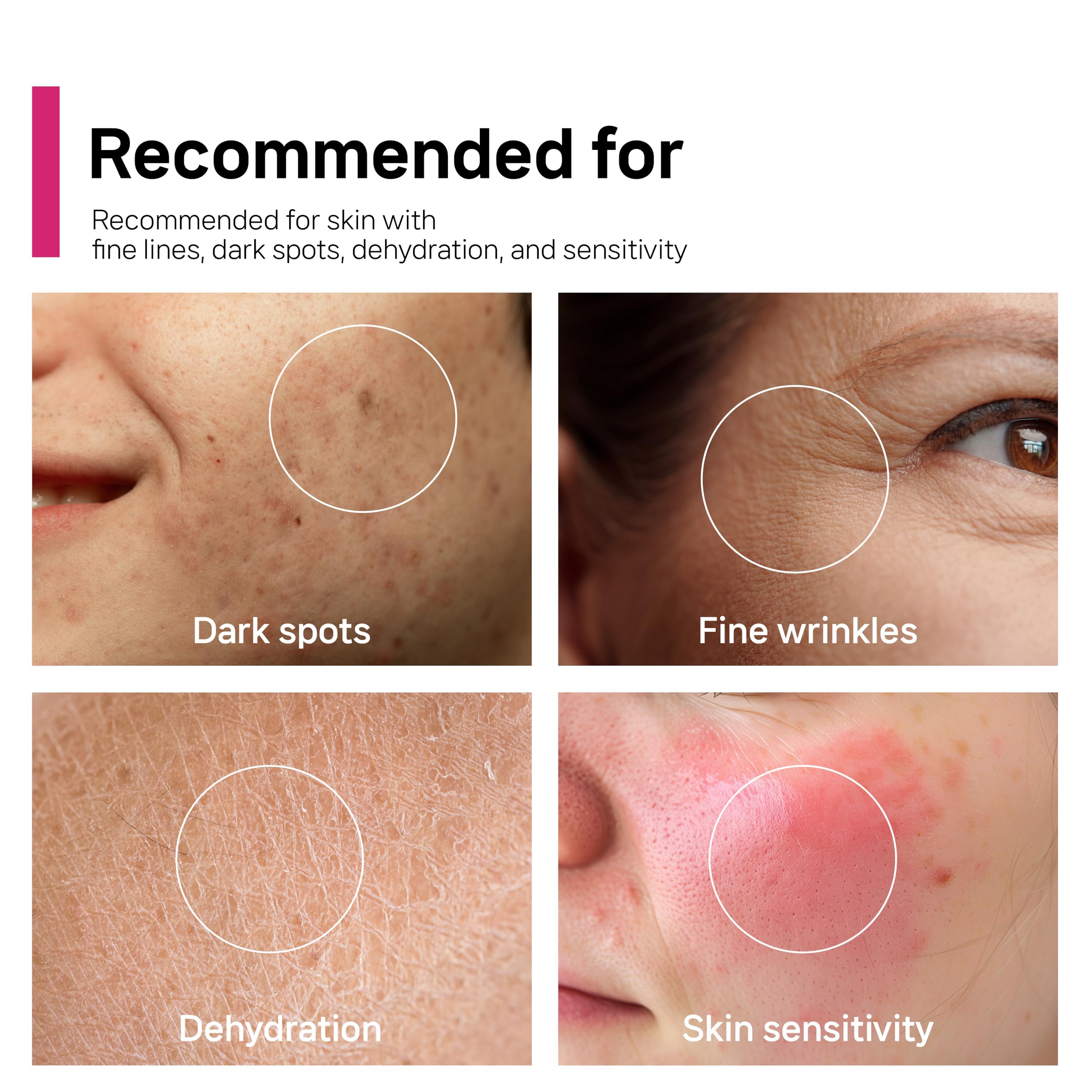 CELDYQUE Barrier-support formula with ceramide NP and squalane protects moisture barrier.