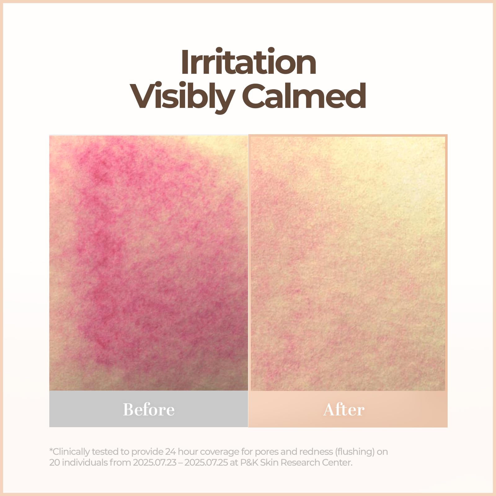 Soft, natural finish visible on the cheek area without heaviness.