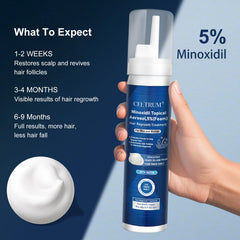 Celtrum Minoxidil Foam dispenser showing precise dosing for consistent scalp treatment.