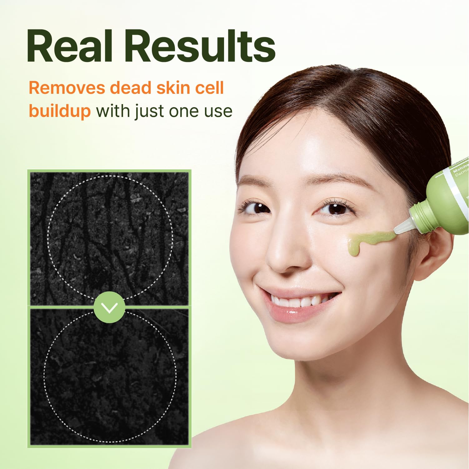 Charcoal capsules in Centellian 24 Madeca Matcha Peeling Gel absorbing impurities