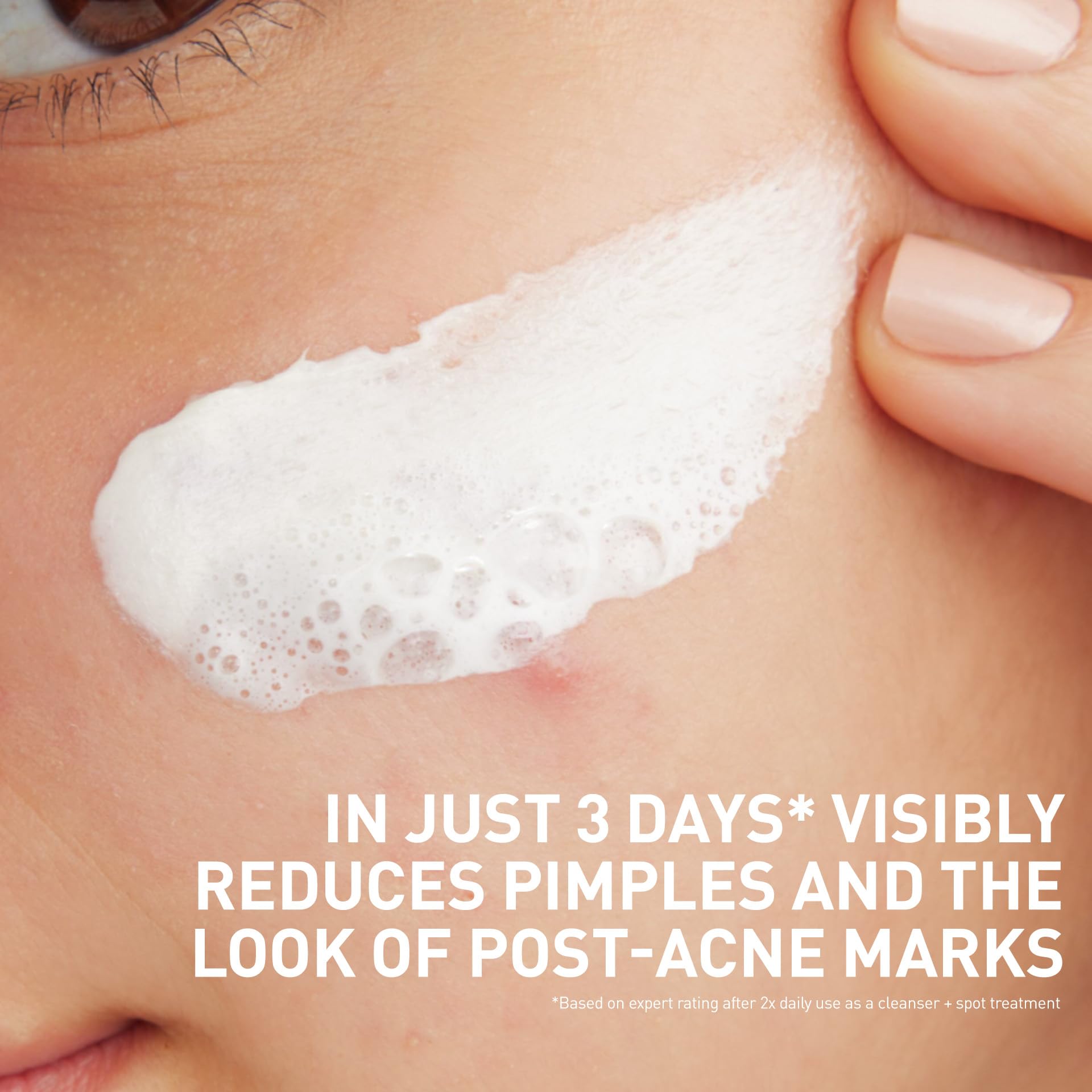 CeraVe 2% Salicylic Acid deposition technology detail promotes lasting acne care