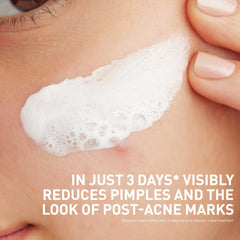CeraVe 2% Salicylic Acid deposition technology detail promotes lasting acne care