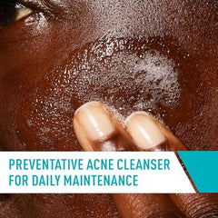 CeraVe Acne Control Cleanser features ceramides to support the skin barrier during cleansing.