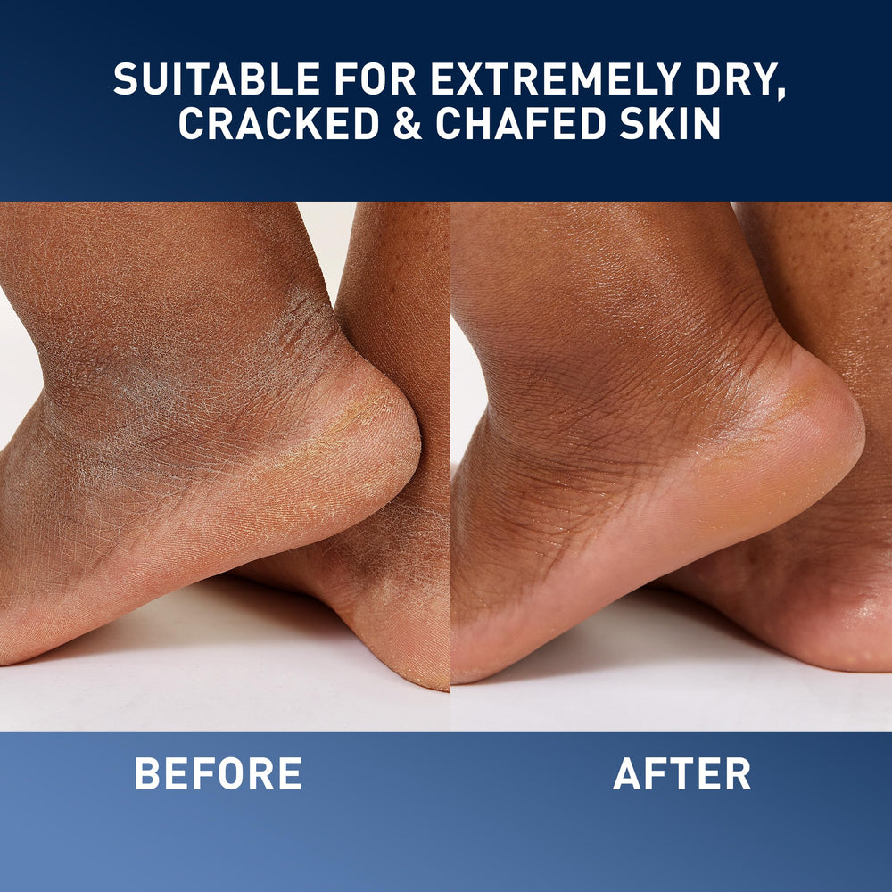 Face and body use for moisturized skin with a non-greasy finish.