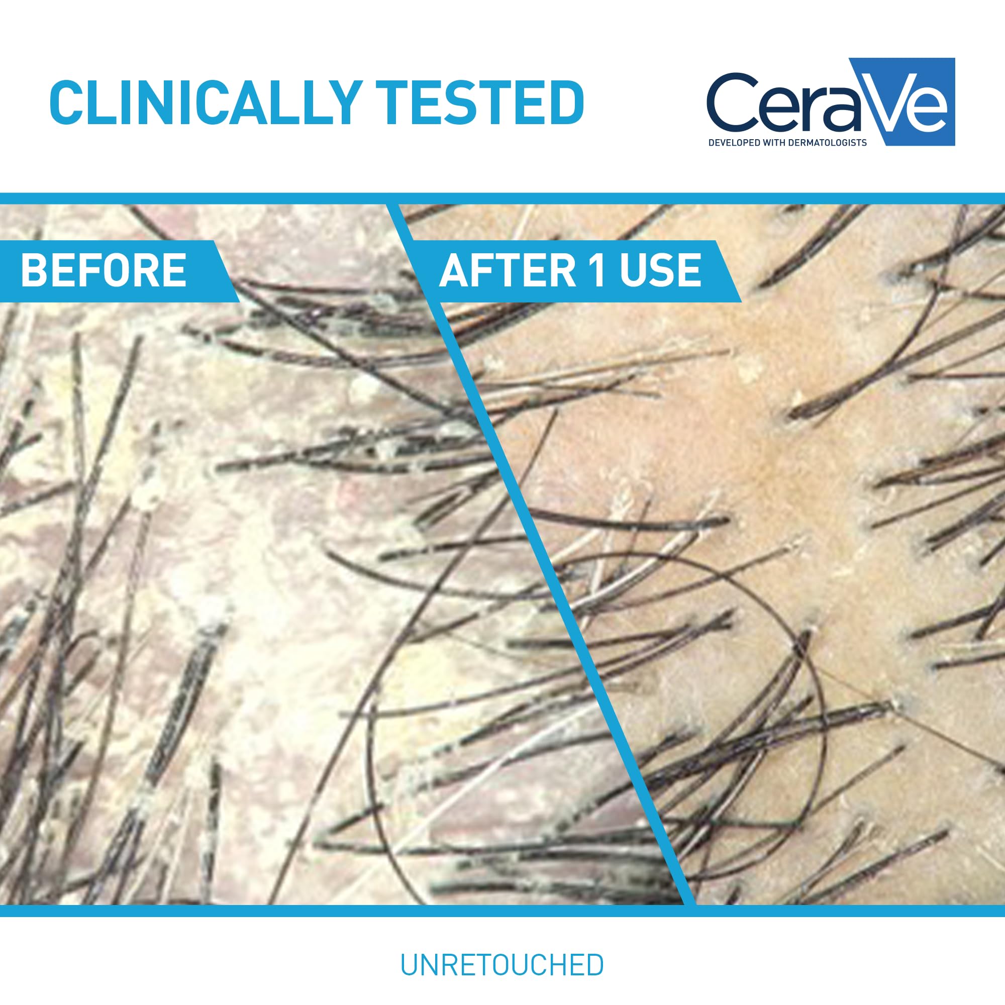 CeraVe Hydrating Anti-Dandruff Shampoo lather demonstrates creamy cleansing formula.