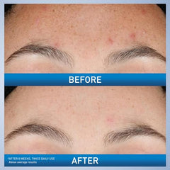 CeraVe Licorice Root Brightening extract close-up hints a brighter-looking complexion