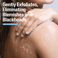 Cetaphil Acne Relief Body Wash label close-up highlights fragrance-free formula.