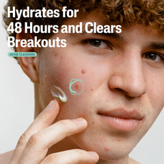Cetaphil Gentle Clear swatch on hand shows light absorption.