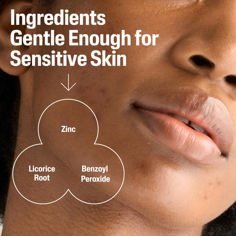 Cetaphil Gentle Clear ideal for sensitive skin in daily routine