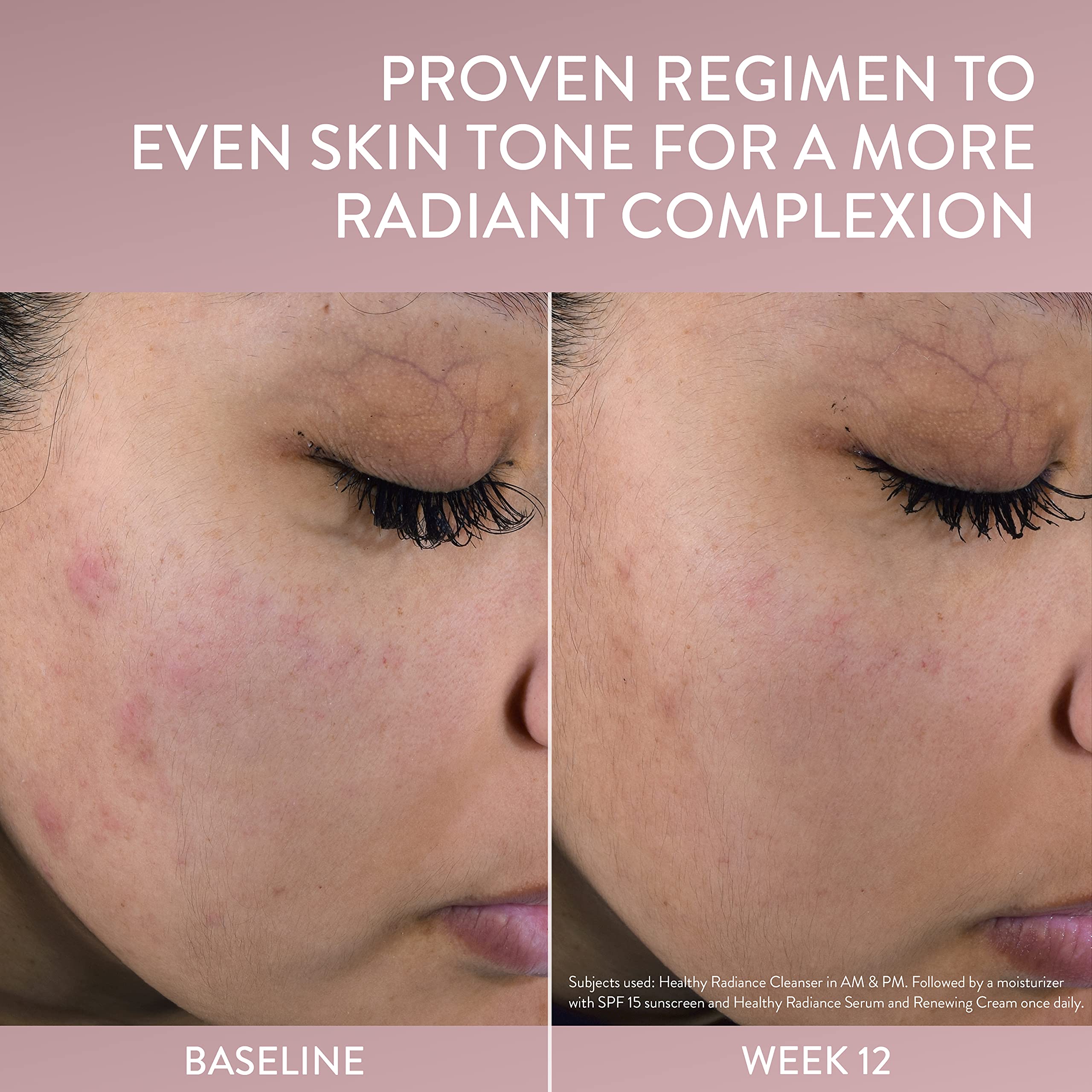 Cetaphil Healthy Radiance serum shown as dermatologist-recommended option for sensitive skin.