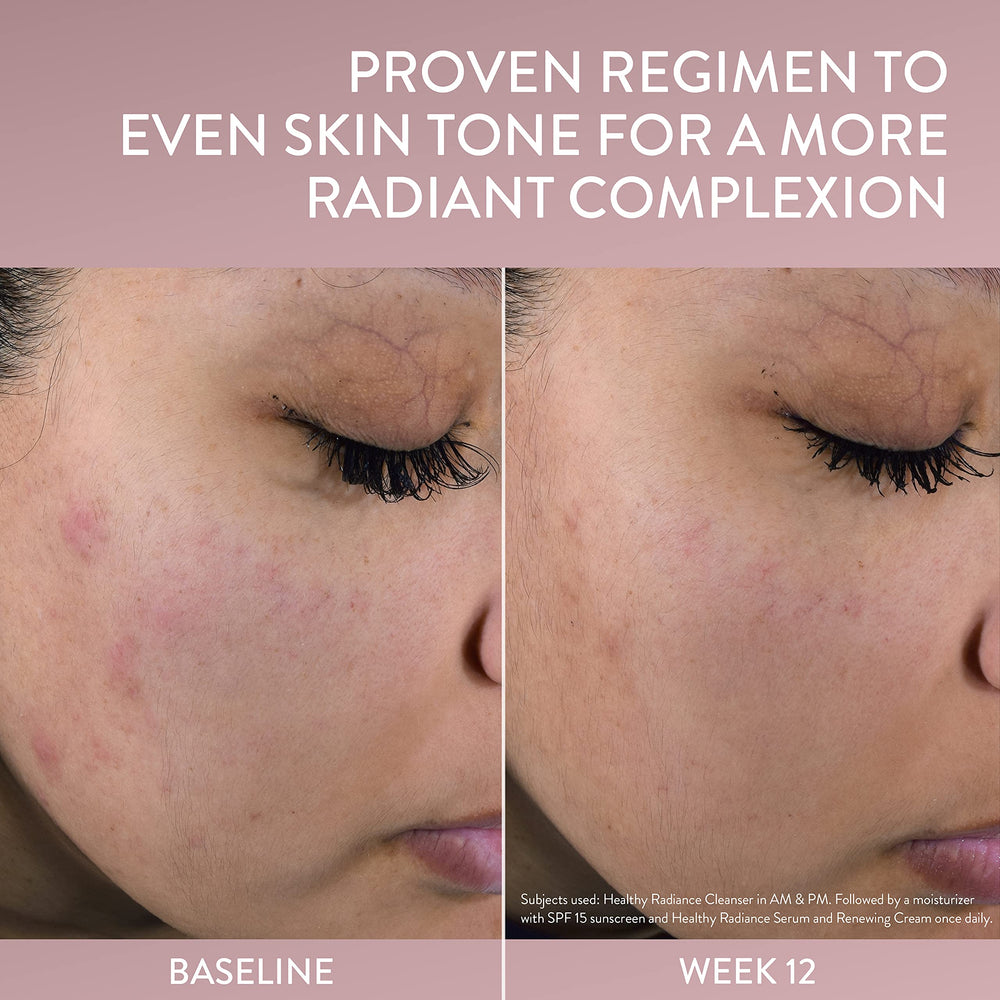 Cetaphil Healthy Radiance serum shown as dermatologist-recommended option for sensitive skin.