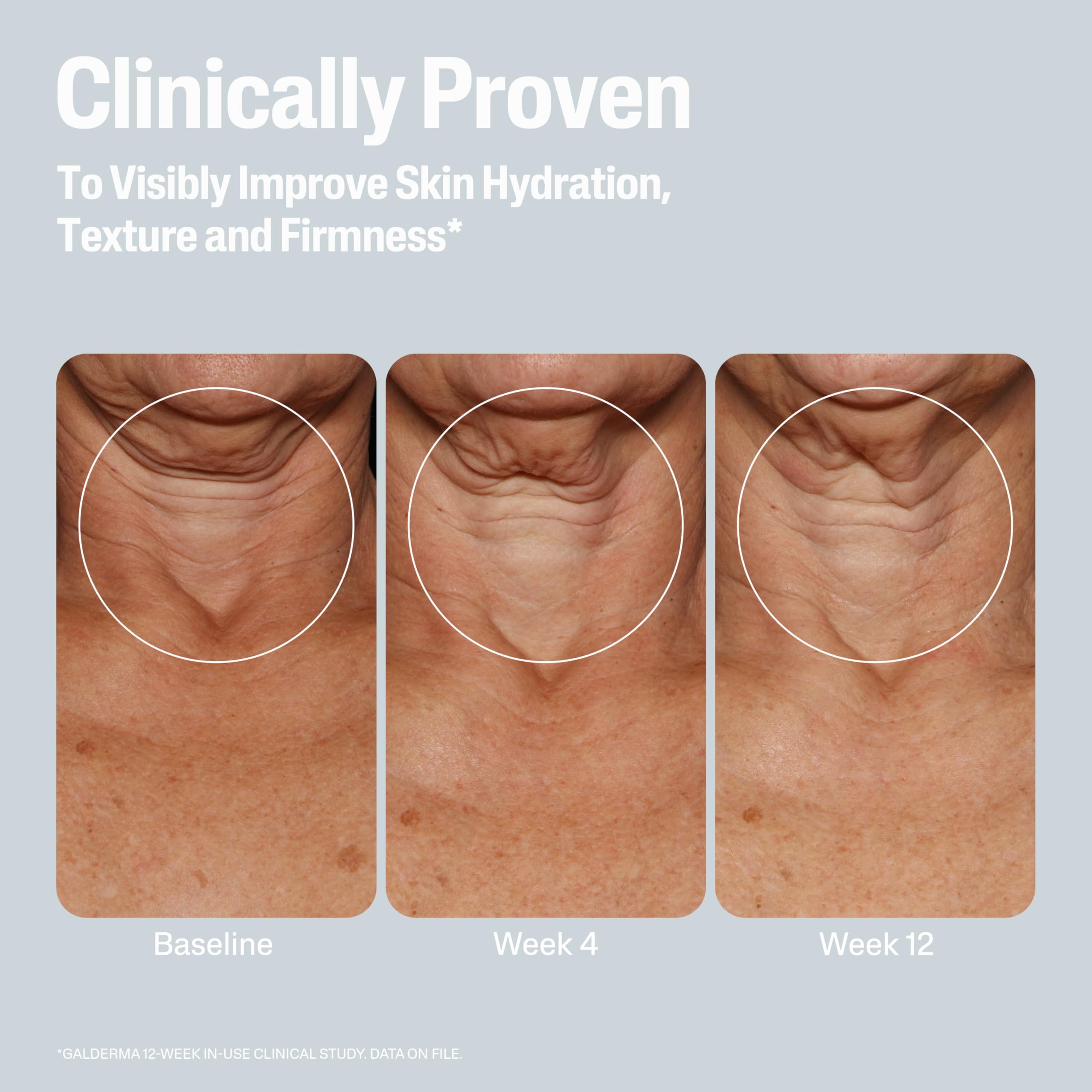 Cetaphil Skin Activator apply-on-arm shows easy daily lotion use.