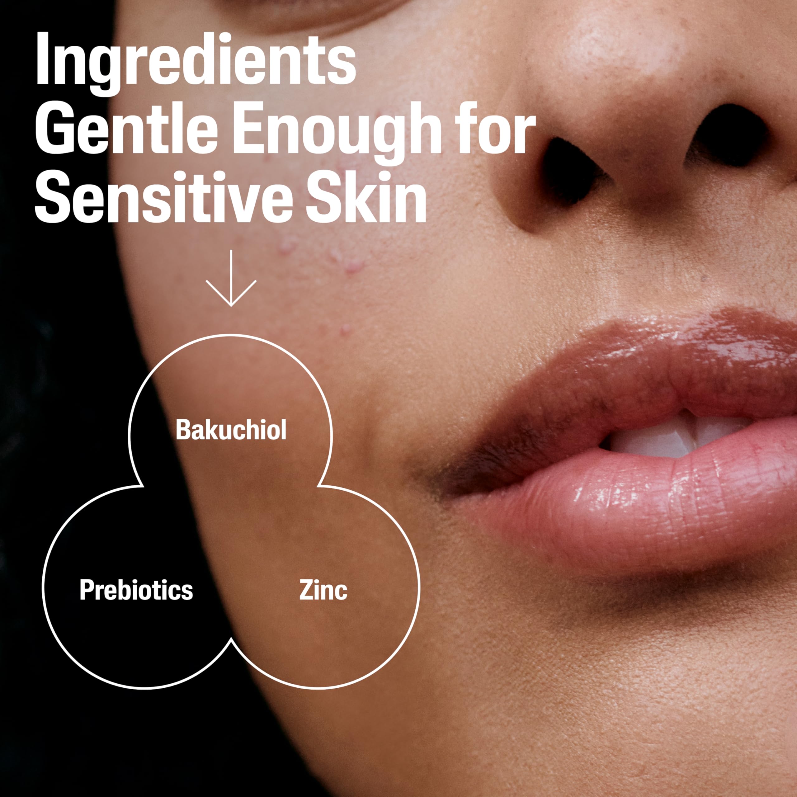 Zinc and Prebiotics formula highlights barrier support and oil control